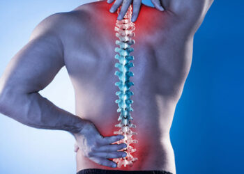 Thoái hóa đốt sống cổ: Biểu hiện, nguyên nhân và cách điều trị