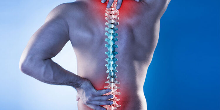 Thoái hóa đốt sống cổ: Biểu hiện, nguyên nhân và cách điều trị