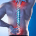 Thoái hóa đốt sống cổ: Biểu hiện, nguyên nhân và cách điều trị