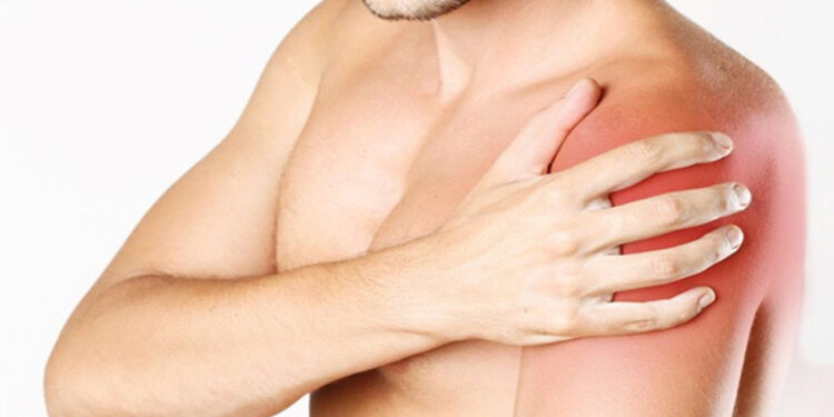 Khô khớp vai là gì? Nguyên nhân, dấu hiệu và cách phòng tránh