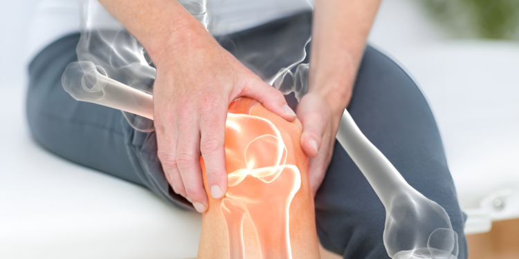 Thoái hóa khớp gối là gì? Dấu hiệu nhận biết và điều trị