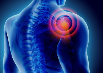 Trật khớp vai là gì? Nguyên nhân, triệu chứng và các phương pháp điều trị