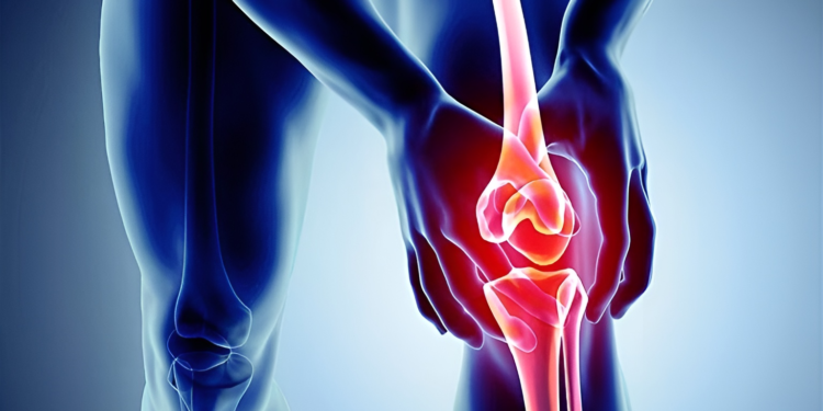 Viêm gân bánh chè: Mối nguy hại tiềm ẩn bạn không thể bỏ qua