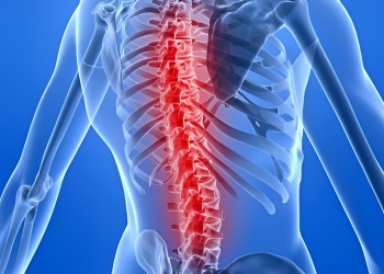 Bệnh lao xương: Nguyên nhân, triệu chứng và cách điều trị