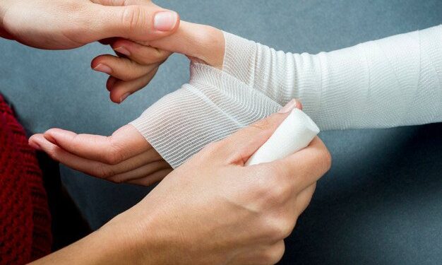 Cách sơ cứu gãy xương đúng cách: Những điều bạn cần biết