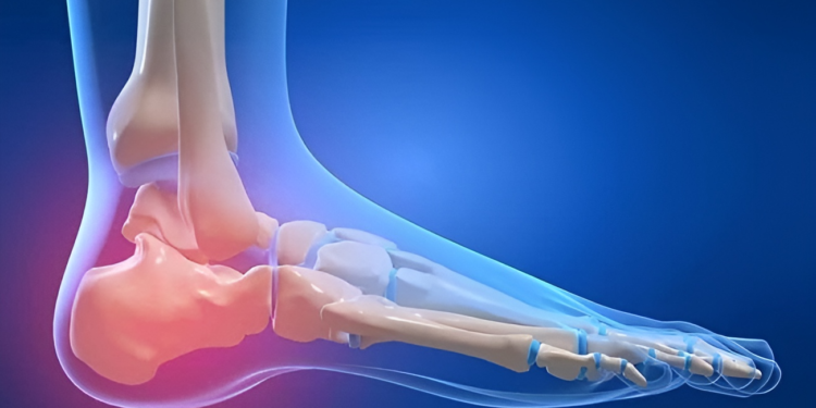 Đau gót chân là bệnh gì? Nguyên nhân và cách phòng tránh