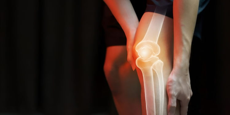 Dấu hiệu ung thư xương: Cách chẩn đoán và phòng tránh