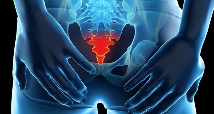 Đau xương cụt là bệnh gì? Nguyên nhân và cách điều trị