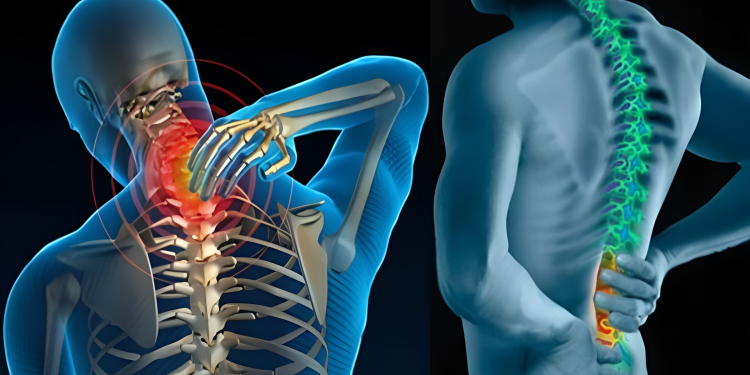 Gai xương là gì? Nguyên nhân, triệu chứng và cách điều trị