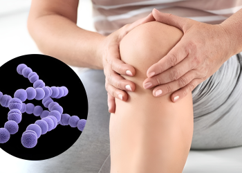 Viêm khớp liên cầu: Nguyên nhân, dấu hiệu và cách điều trị