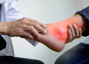 Đau mắt cá chân là bệnh gì? Nguyên nhân, triệu chứng và cách điều trị bệnh