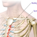 Gãy xương ức là gì? Nguyên nhân, triệu chứng và phương pháp điều trị