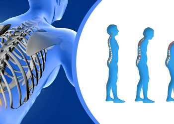 Loãng xương là gì? Nguyên nhân, dấu hiệu nhận biết và phương pháp điều trị bệnh