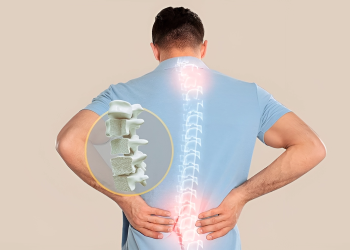 Bệnh nhuyễn xương là gì? Nguyên nhân, dấu hiệu và điều trị