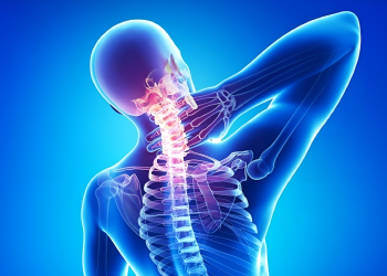 Thoái hóa cột sống cổ là gì? Nguyên nhân và cách điều trị