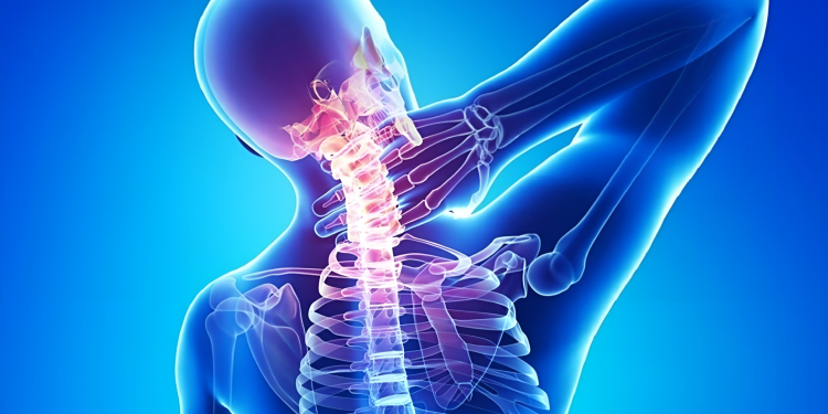 Thoái hóa cột sống cổ là gì? Nguyên nhân và cách điều trị