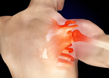 Cấu tạo khớp vai như thế nào? Những điều bạn cần biết