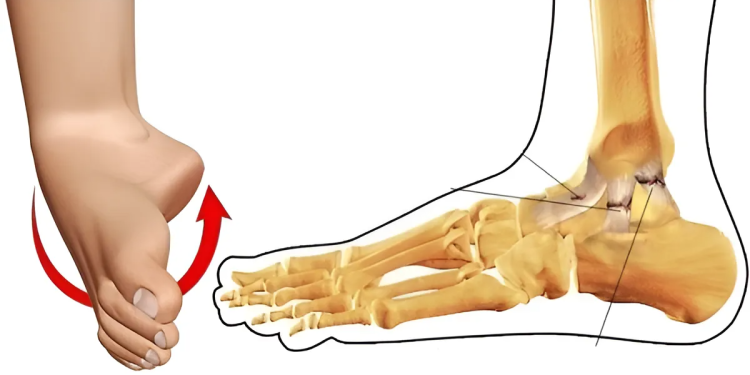 Nứt xương bao lâu thì lành? Nguyên nhân, triệu chứng và cách điều trị