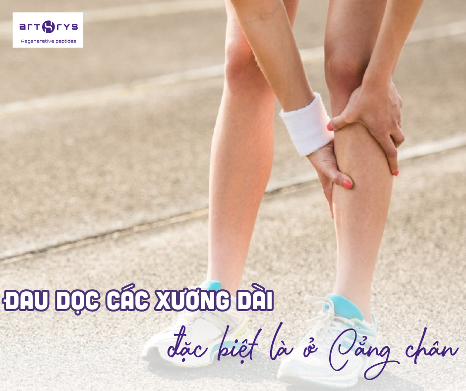 Dấu hiệu loãng xương là đau dọc các xương dài đặc biệt là cẳng chân