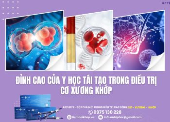 Arthrys – Đỉnh cao của y học tái tạo trong điều trị Cơ Xương Khớp