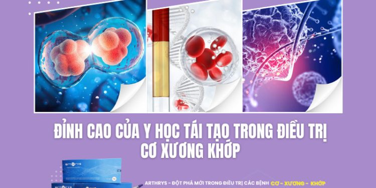 Arthrys – Đỉnh cao của y học tái tạo trong điều trị Cơ Xương Khớp