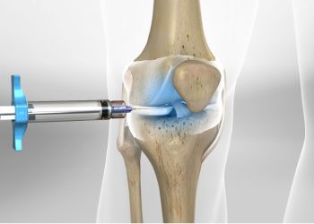 Tại sao phải tiêm dưỡng chất sau phẫu thuật khớp được nhiều người quan tâm