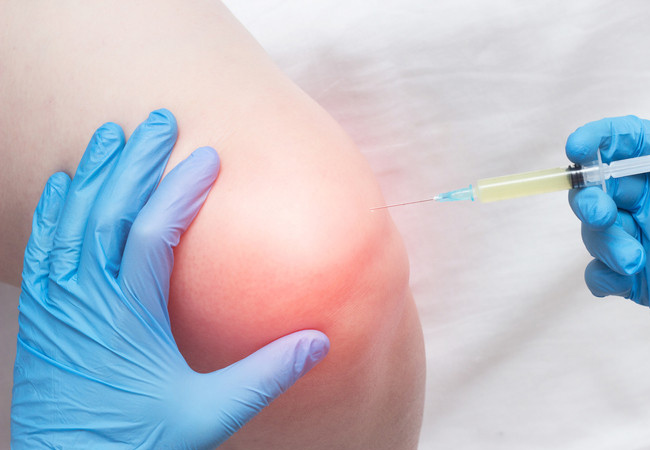 Acid hyaluronic giúp giảm ma sát và giảm đau khớp