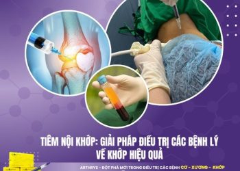 Tiêm nội khớp: Giải pháp điều trị các bệnh lý về khớp hiệu quả