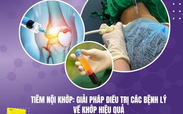 Tiêm nội khớp: Giải pháp điều trị các bệnh lý về khớp hiệu quả