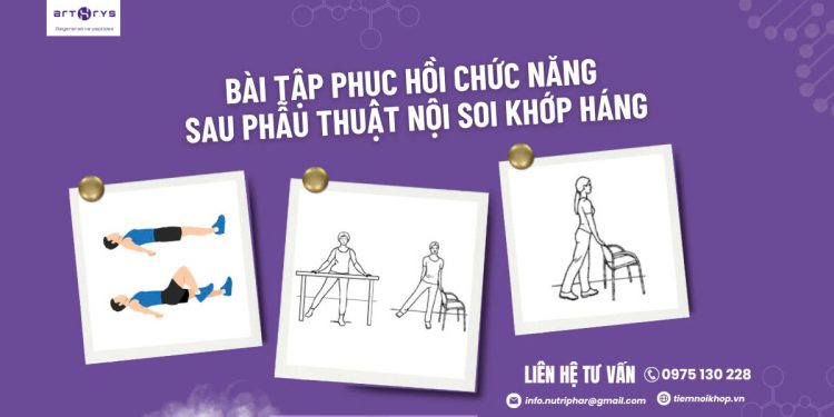 Bài tập phục hồi chức năng sau phẫu thuật nội soi khớp háng