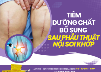 Bổ sung gì sau phẫu thuật nội soi khớp?