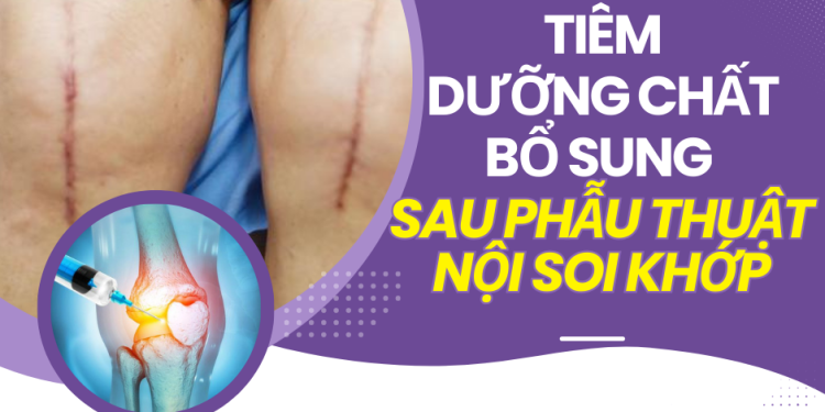 Bổ sung gì sau phẫu thuật nội soi khớp?