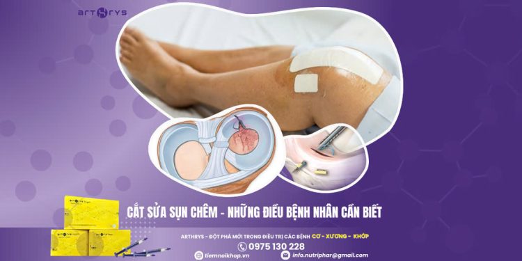 Cắt sửa sụn chêm – Những điều bệnh nhân cần biết