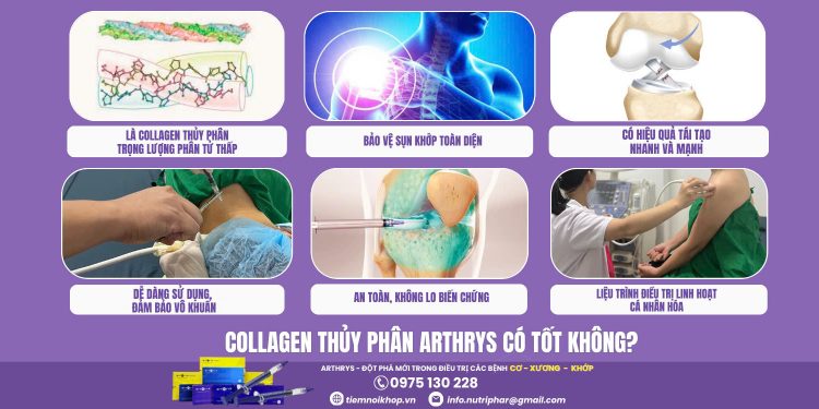 Collagen thủy phân Arthrys có tốt không?