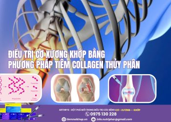 Điều trị Cơ Xương Khớp bằng phương pháp tiêm Collagen thủy phân