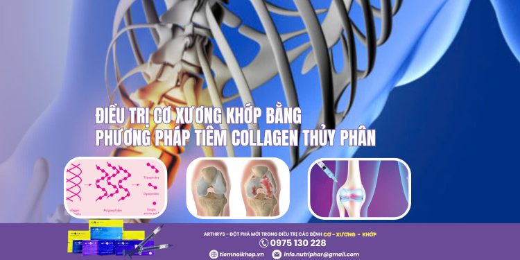 Điều trị Cơ Xương Khớp bằng phương pháp tiêm Collagen thủy phân