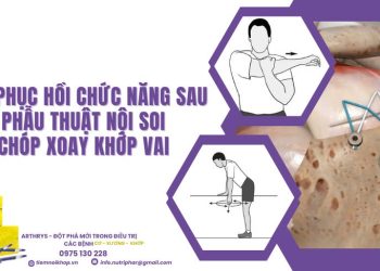 Tập phục hồi chức năng sau phẫu thuật nội soi chóp xoay khớp vai