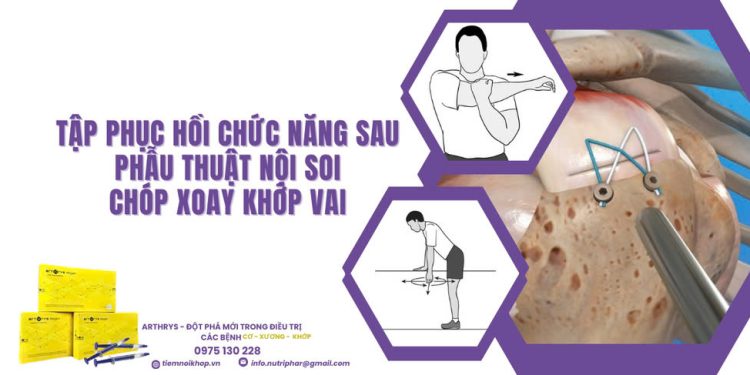 Tập phục hồi chức năng sau phẫu thuật nội soi chóp xoay khớp vai