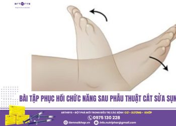 Bài tập phục hồi chức năng sau phẫu thuật cắt sửa sụn chêm