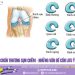 Chấn thương sụn chêm – Những vấn đề cần lưu ý