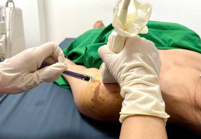 Chi phí tiêm Collagen thủy phân Arthrys rất hợp lí so với công dụng sản phẩm mang lại