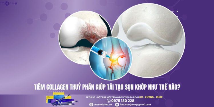 Tiêm Collagen thủy phân giúp tái tạo sụn khớp như thế nào?