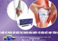 Xu hướng mới về phác đồ điều trị thoái hóa khớp: Có nên kết hợp tiêm nội khớp?