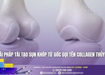 Giải pháp tái tạo sụn khớp từ gốc gọi tên Collagen thủy phân